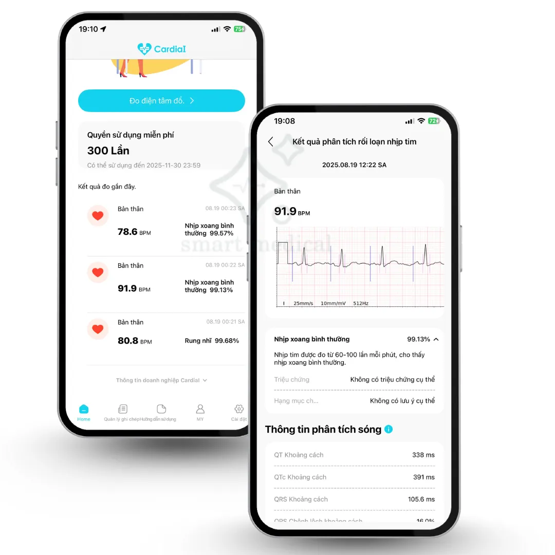 smartmedical bán thiết bị theo dõi điện tim holter Cardiai 300