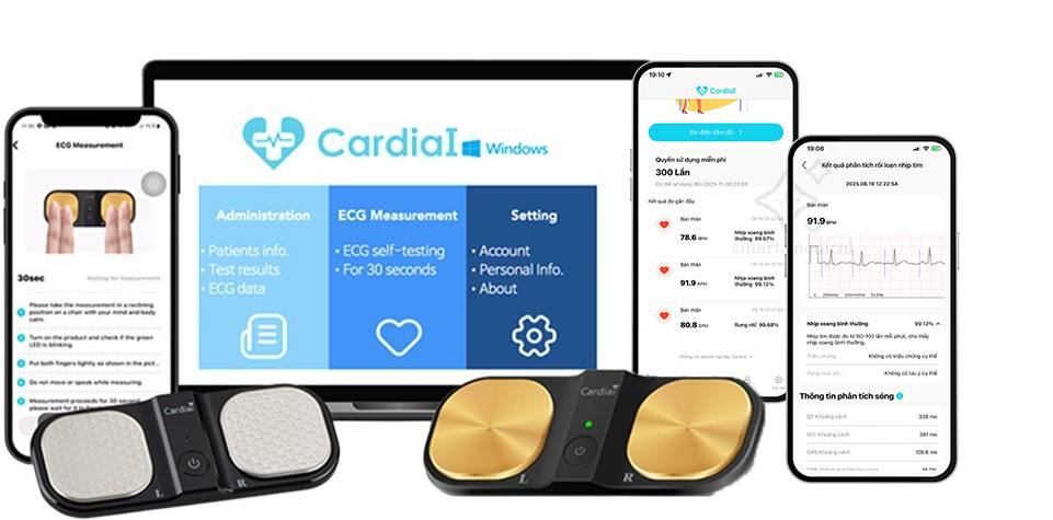 ecg-cardiai-cai-100-do-dien-tam-do-smart-medical