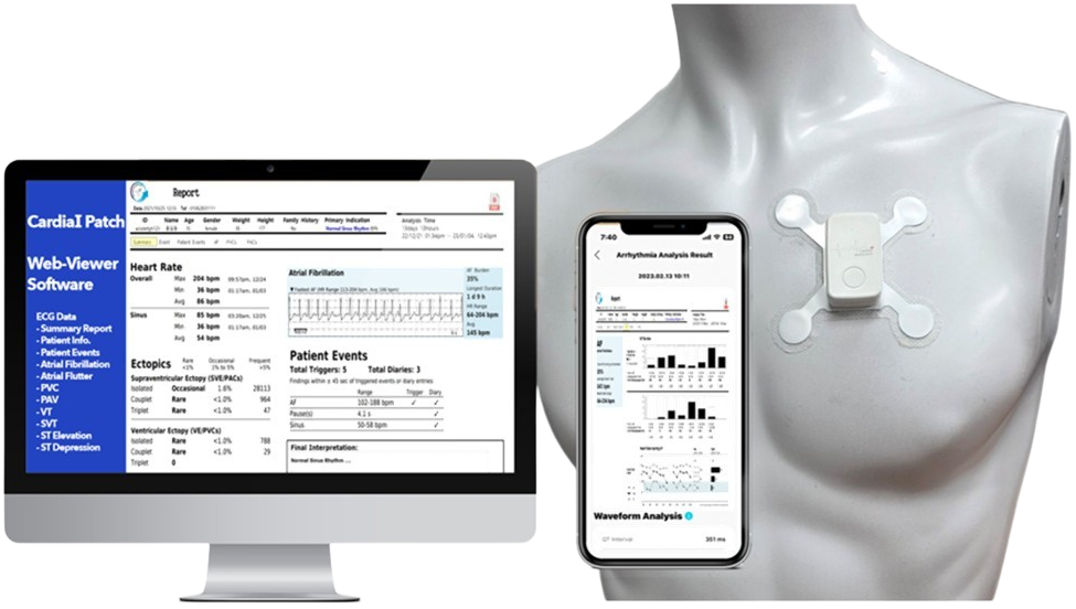 holter-cardiai-cai-300-do-tim-ca-nhan-smart-medical
