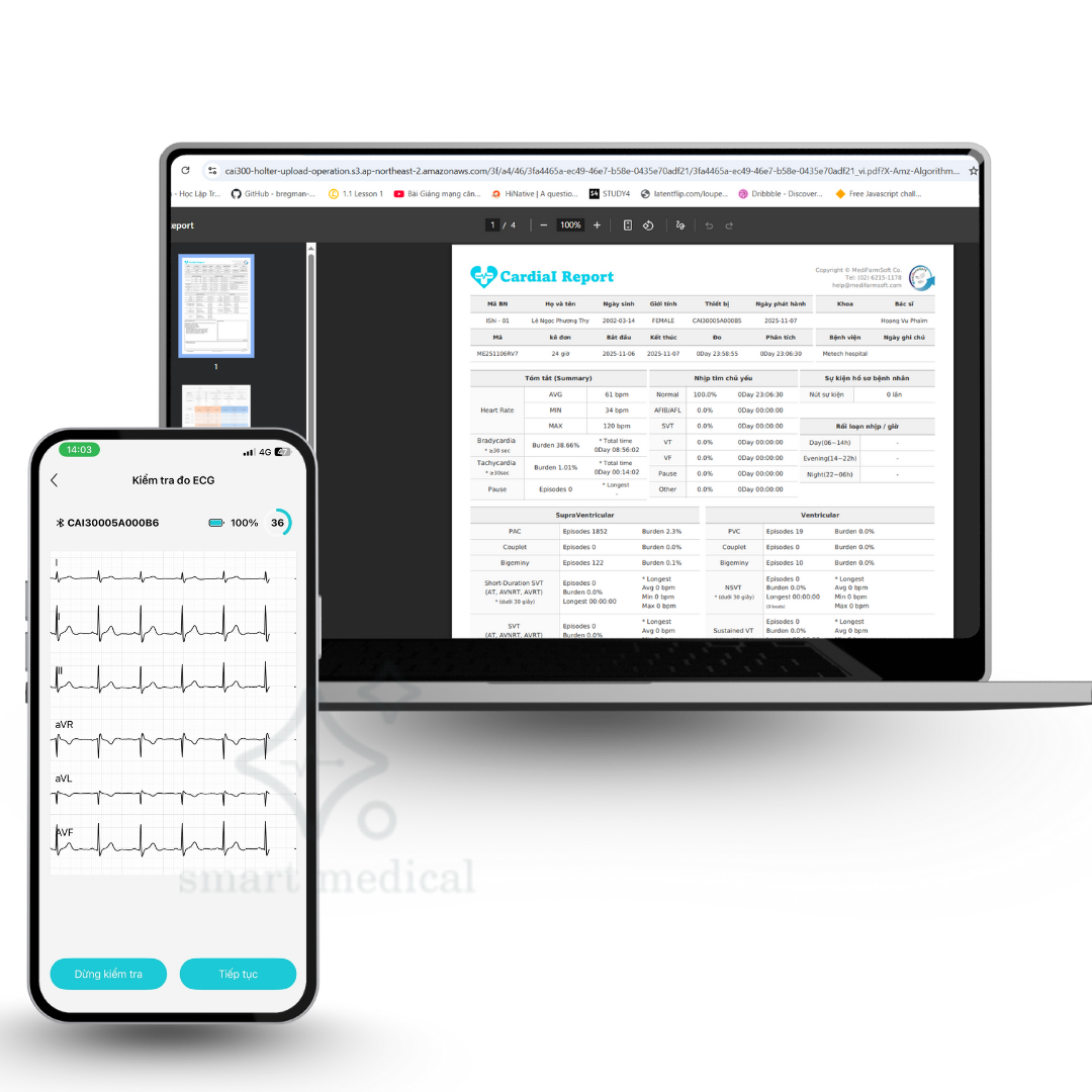 smartmedical bán thiết bị theo dõi điện tim holter Cardiai 300